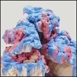 Battles - Dloss Grop 1